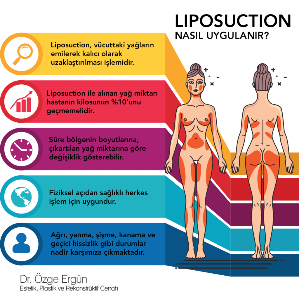 Liposuction uygulanma şekli