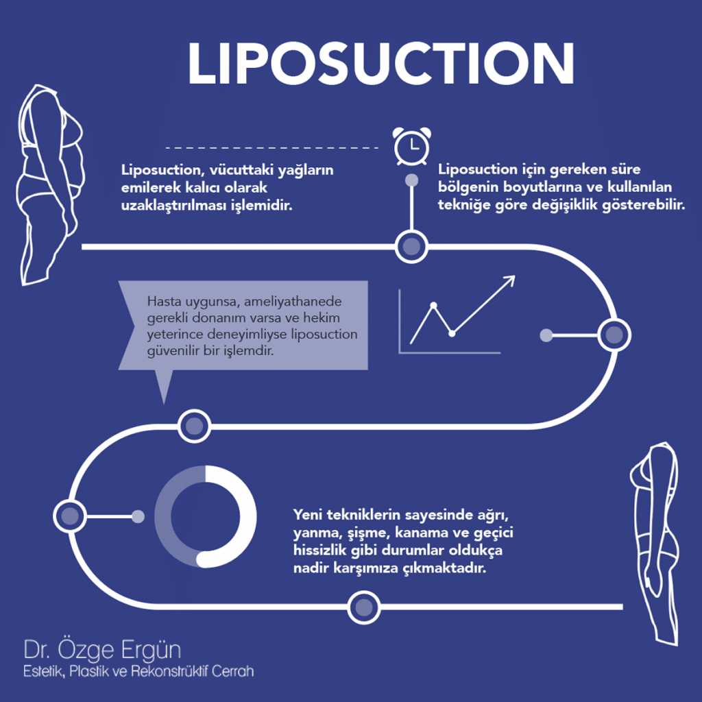 liposuction info