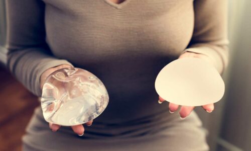 The Lifespan of Breast Implants